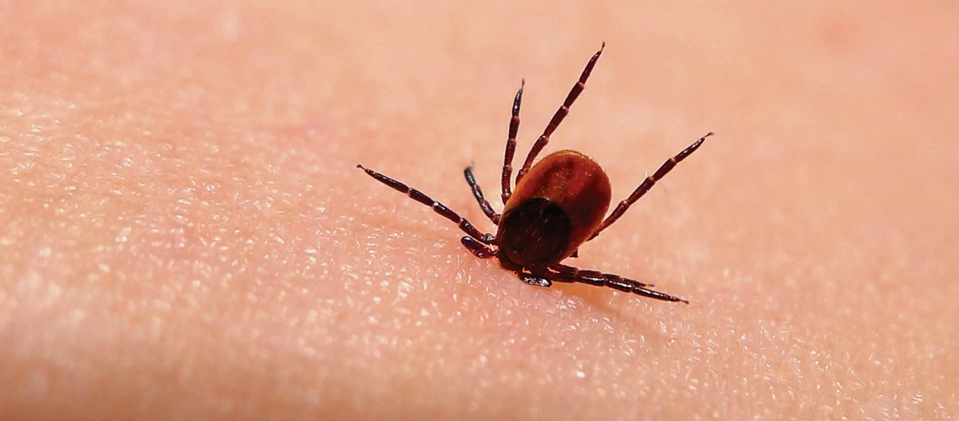 Tι είναι η νόσος Lyme από την οποία πάσχει ο Τζάστιν Μπίμπερ;